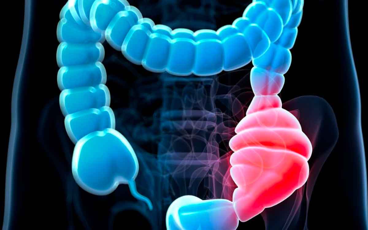 if you eat these foods you will get constipation 