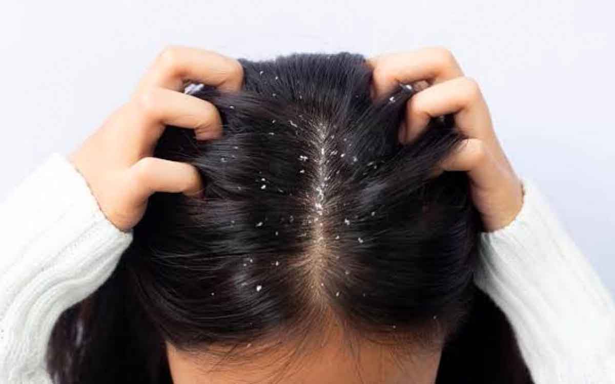 do like this with tulsi leaves to get rid of dandruff 