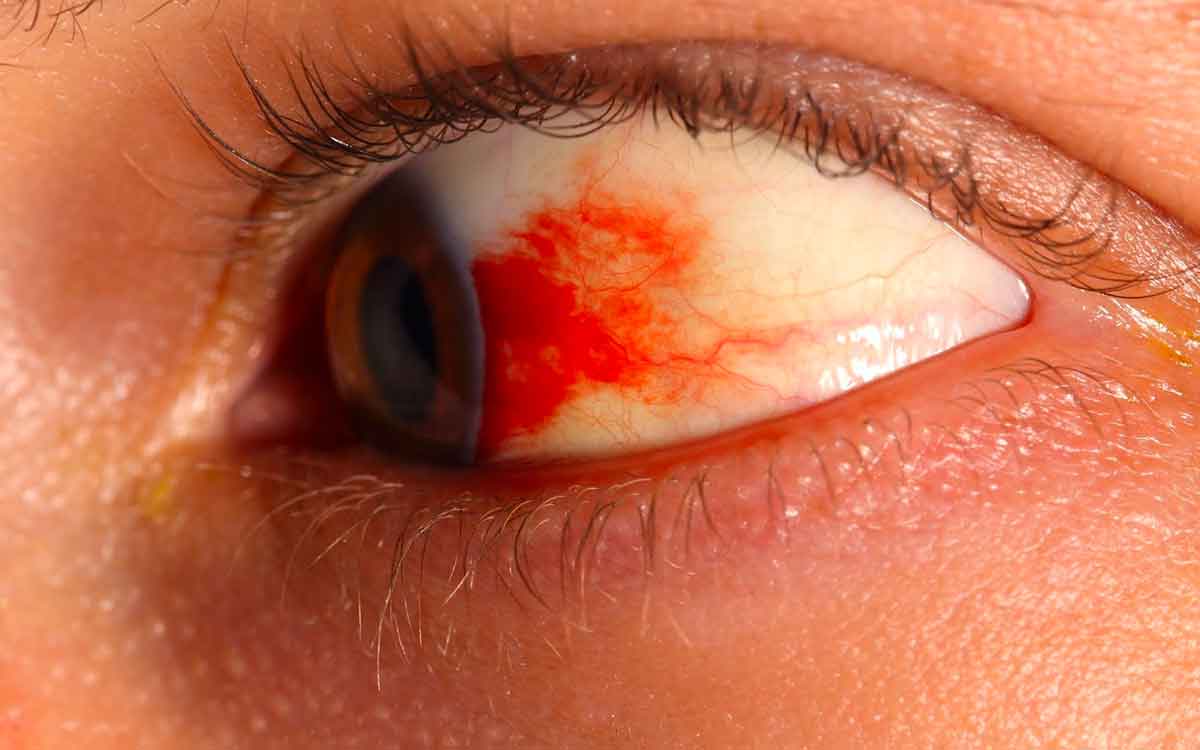 what is diabetic retinopathy and how to avoid it 