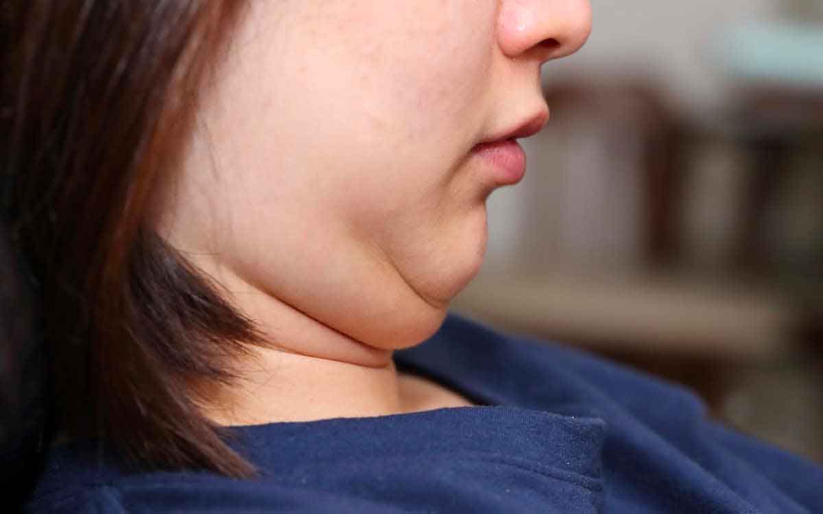 follow these home remedies to get rid of double chin 