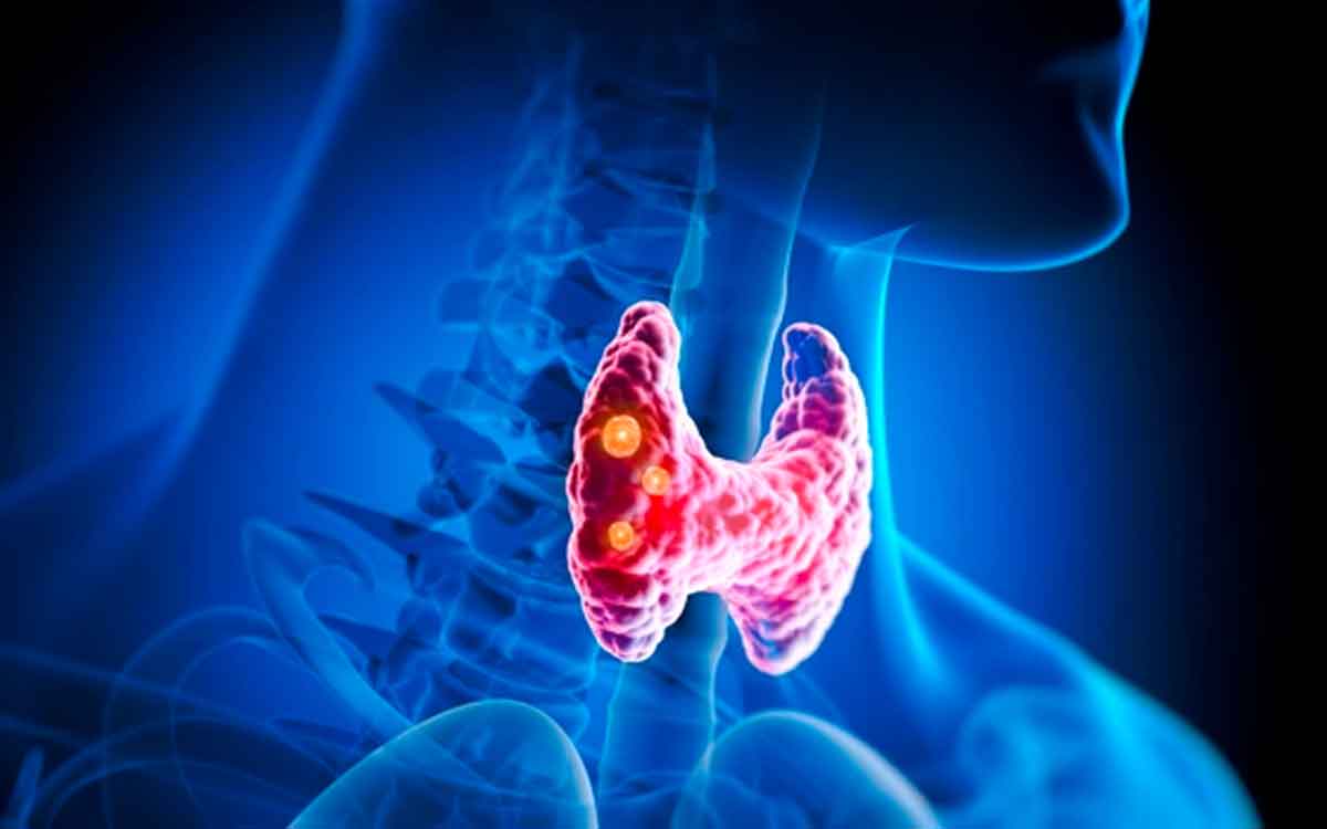 if you are suffering from thyroid problem take these foods 