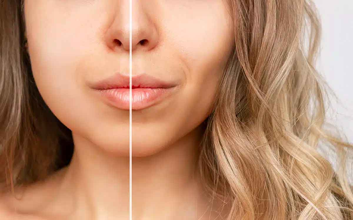 here it is how you can reduce your facial fat 