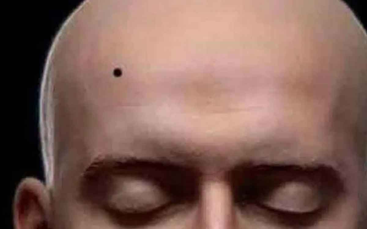 what happens if men have birth marks on these places 