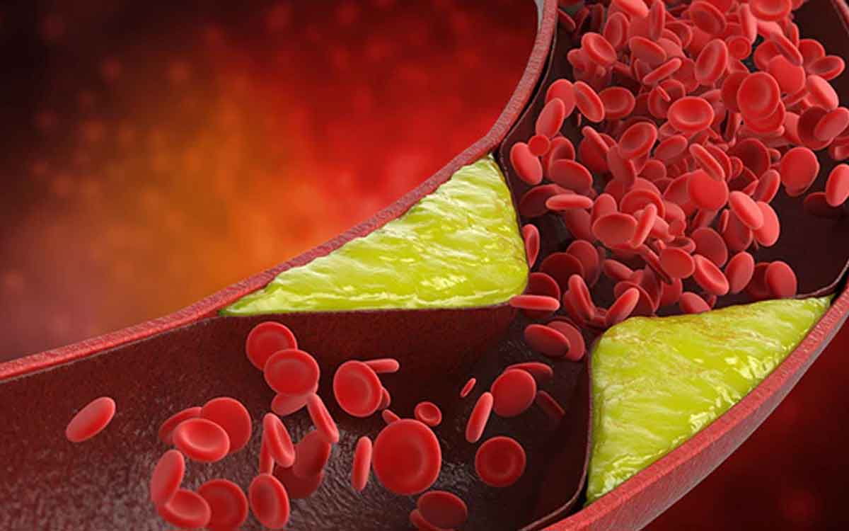 if you have high cholesterol in your body follow this diet 