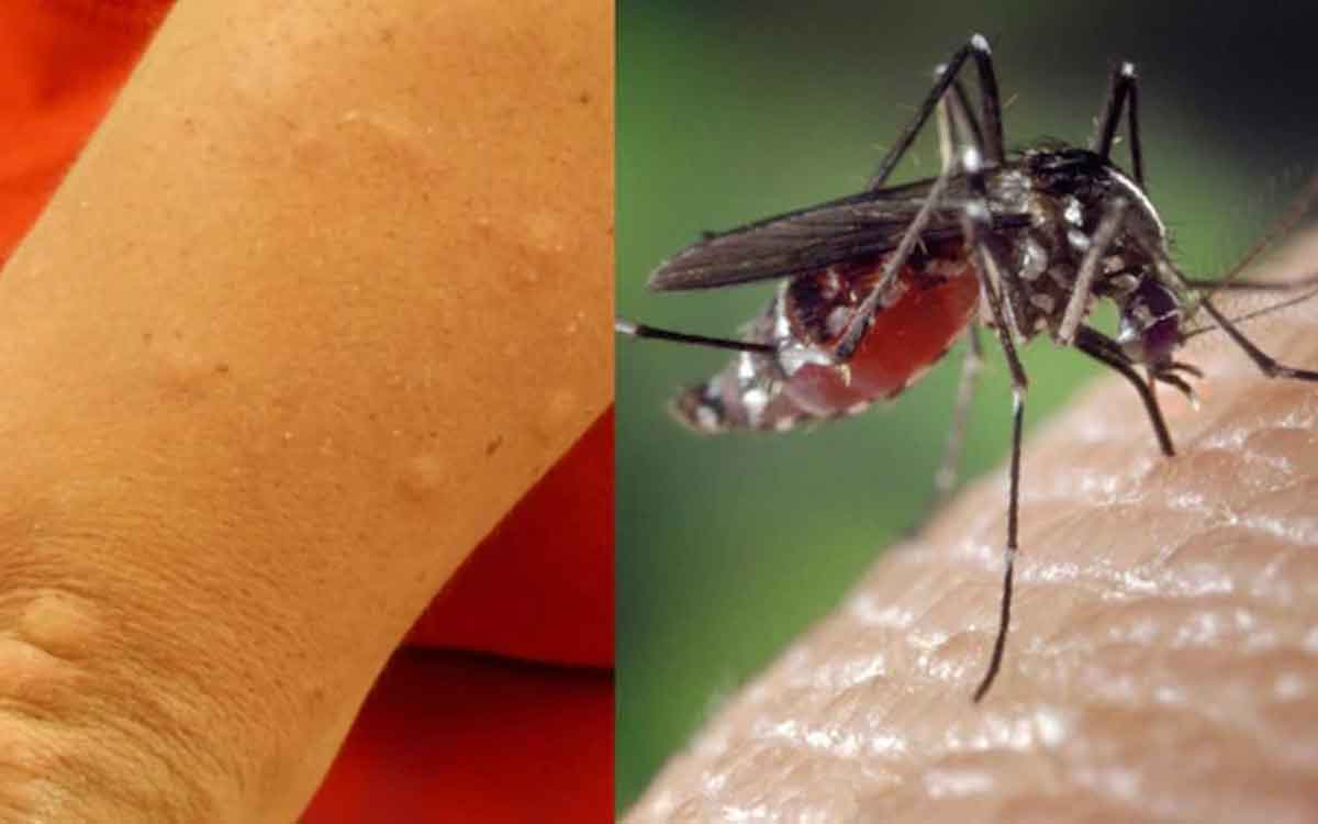mosquitoes do not like these know about them 