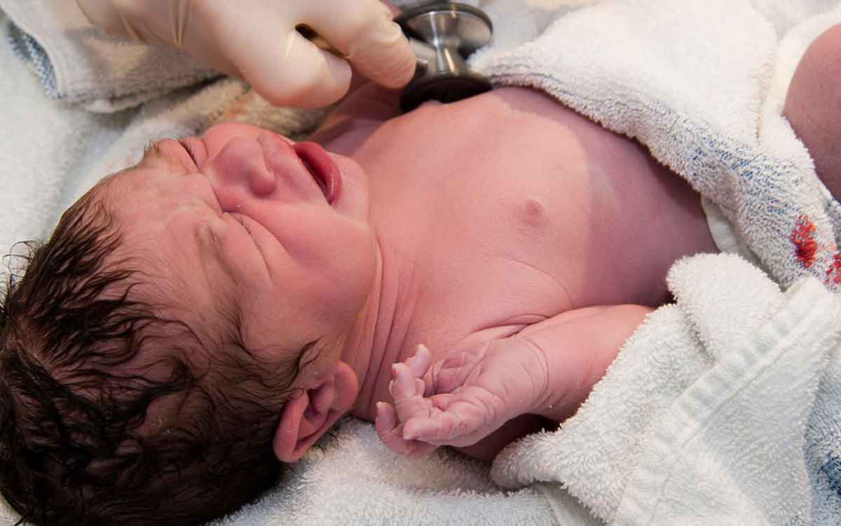 why new born babies will get jaundice 