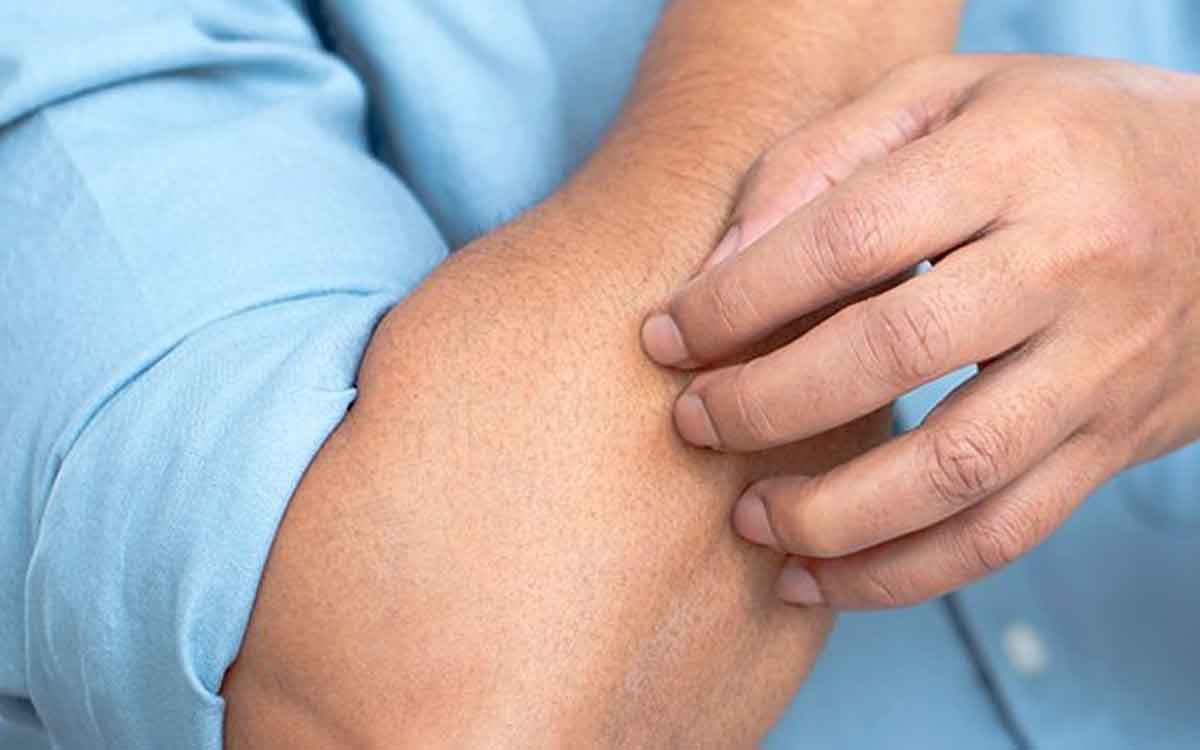 if you have diabetes then you must take care of skin health 