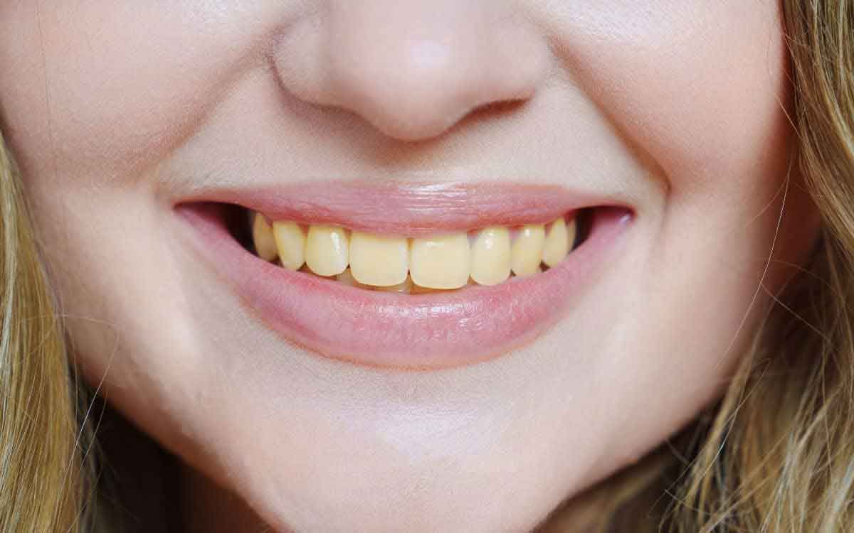 if your teeth became yellow then these might be the reasons 